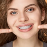 Teeth Straightening: The Secret Behind A Beautiful Smile