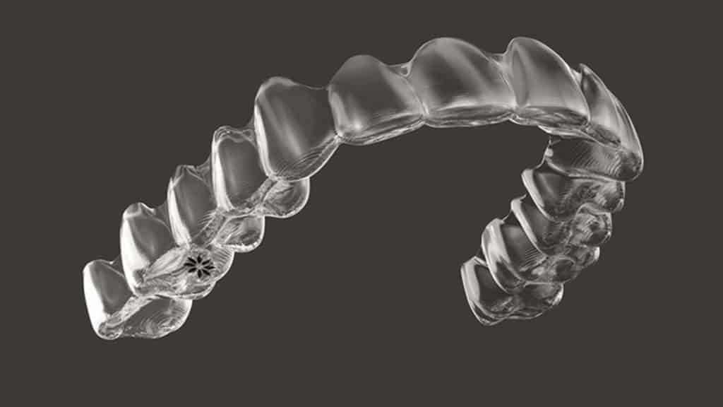Orthodontic Issues Invisalign