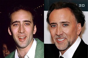 nicolas cage dentist