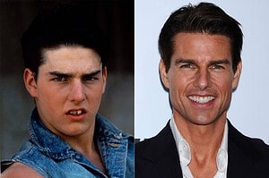 tom cruise liverpool dentist