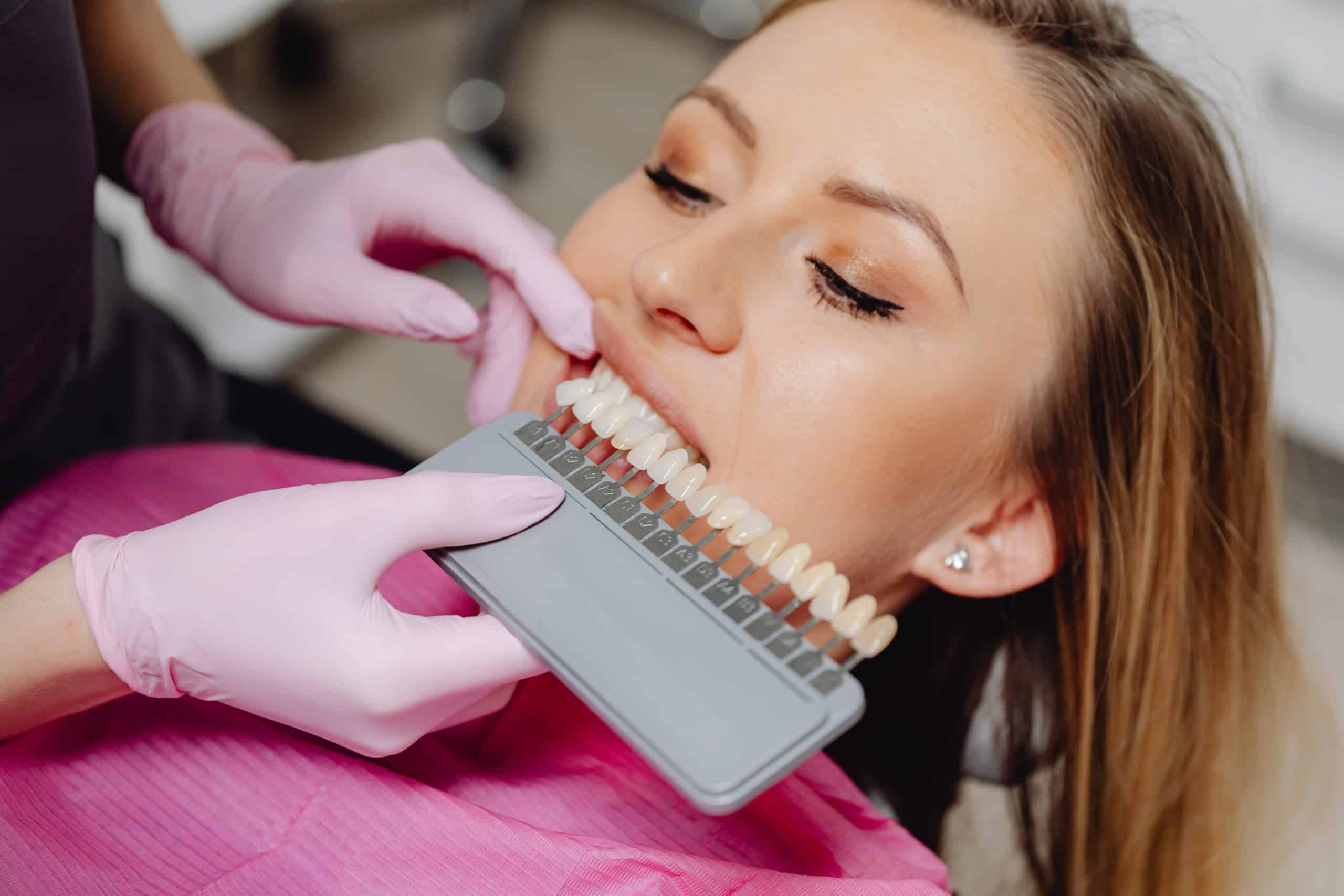 Liverpool dentist: When Are Veneers Recommended?