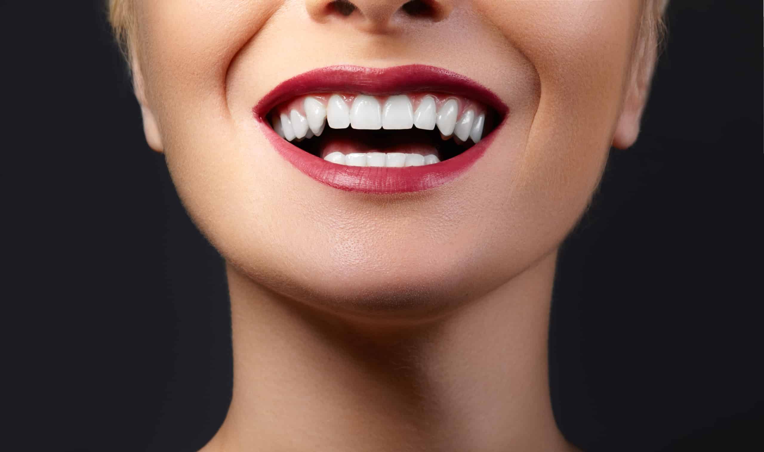 an image of a woman smiling after getting composite bonding