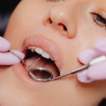 Aftercare Tips: What to Do After Seeing an Emergency Dentist in Liverpool