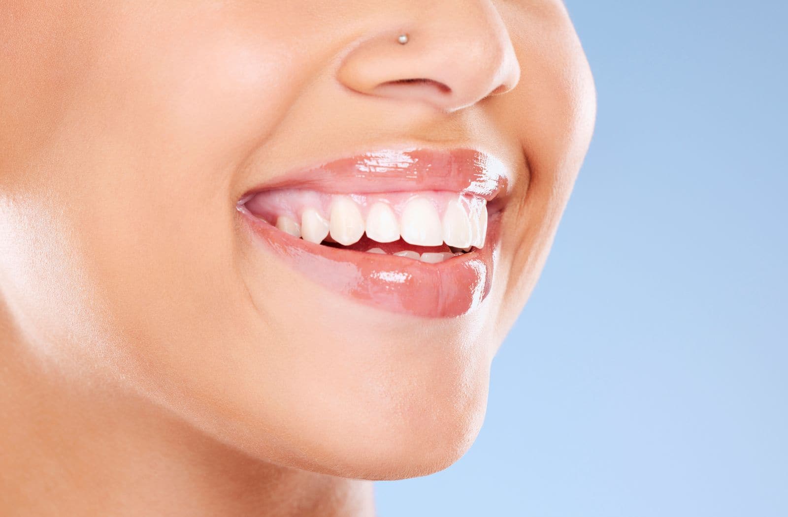 Invisalign treatment in Liverpool