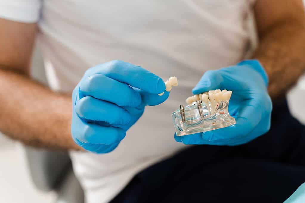 Implants for missing teeth